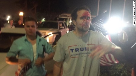 trump-protest-bloody-large-169.jpg
