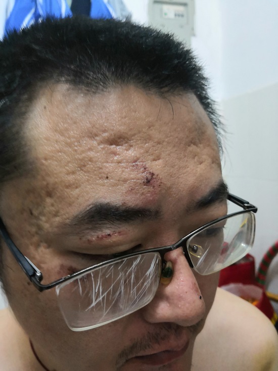 IMG_20190708_203311-baidu.jpg