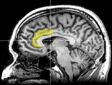 220px-MRI_anterior_cingulate.png